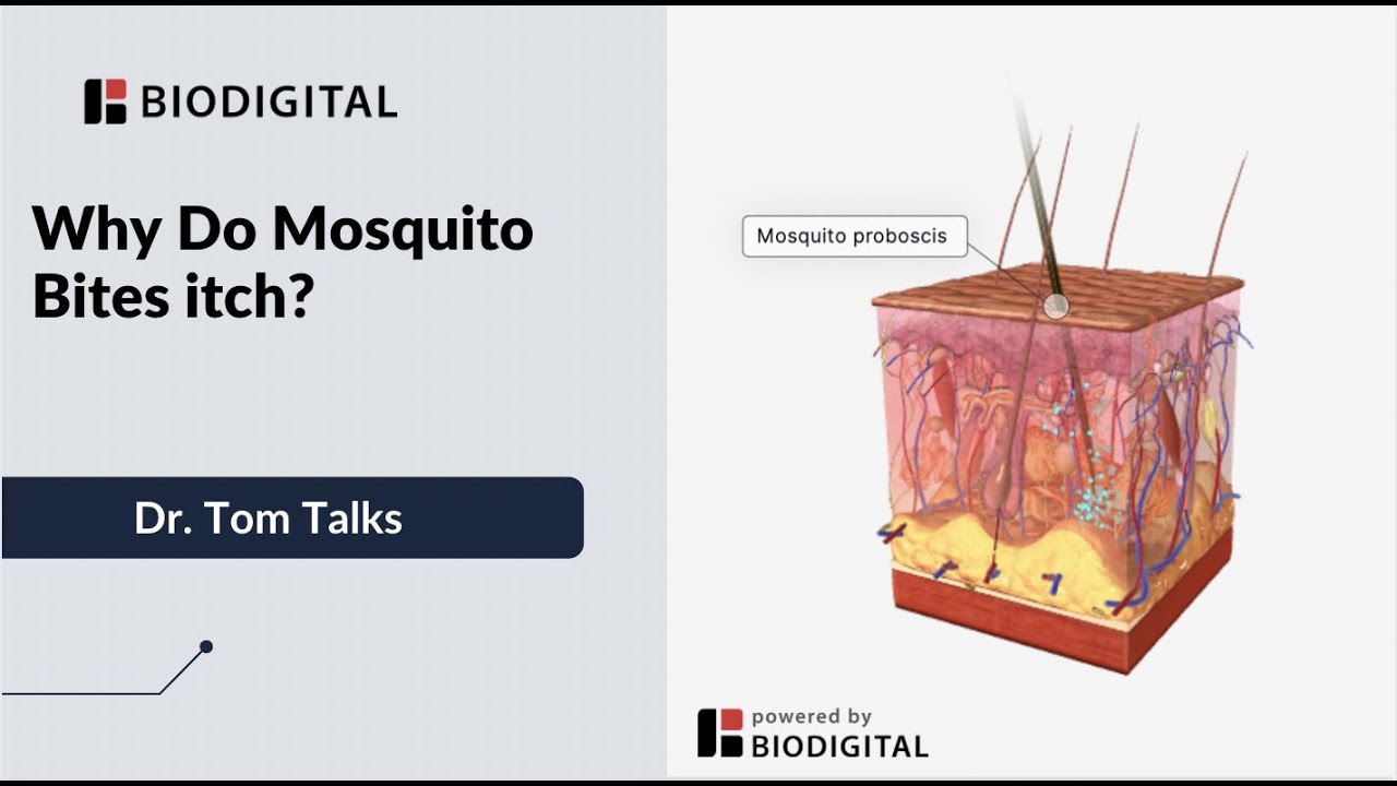 Why Do Mosquito Bites Itch? - Dr. Tom Talks