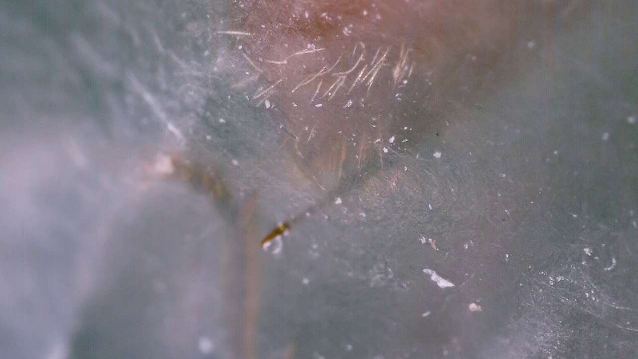 Ant Stingers & Venom Delivery