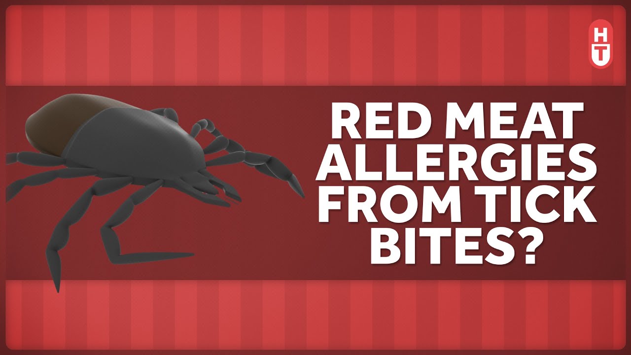 How Can a Tick Bite Make You Allergic to Red Meat?