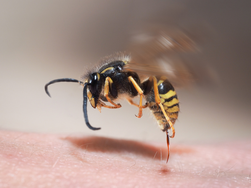 Wasp sting pulls out of human skin, visual of a yellowjacket sting