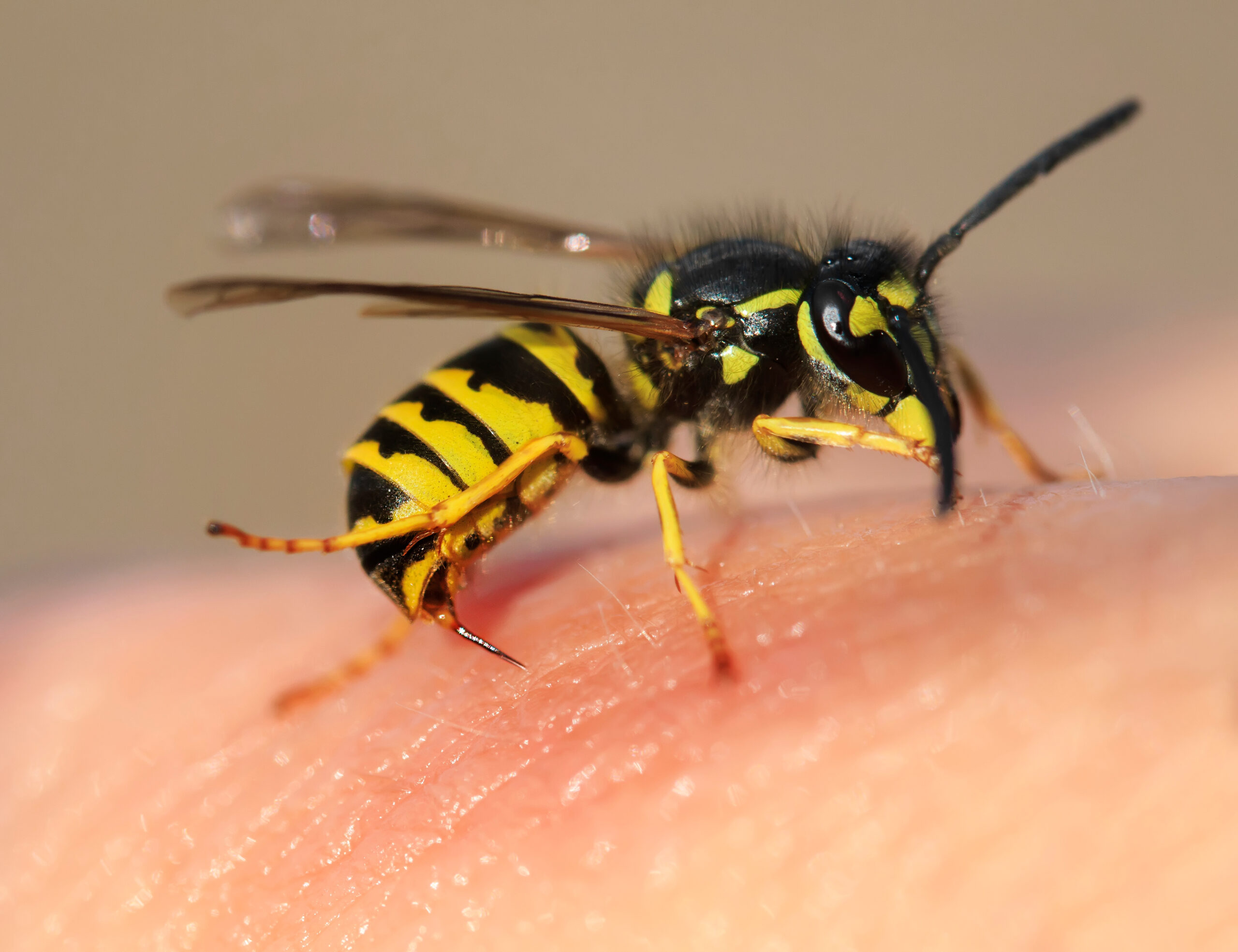 Wasp sting